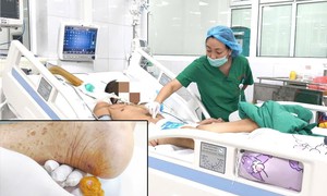 Gà mổ vào gót chân khiến cụ ông nguy kịch