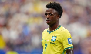 Diện mạo khiến fan suýt không nhận ra của sao bóng đá Brazil sau phẫu thuật cằm