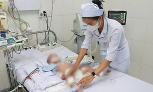 Bệnh viện tuyến tỉnh lần đầu lọc máu liên tục cứu sống bệnh nhi 16 tháng tuổi mắc tay chân miệng nguy kịch