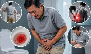 Nam giới 50 tuổi vì sao cần tầm soát ung thư tuyến tiền liệt?