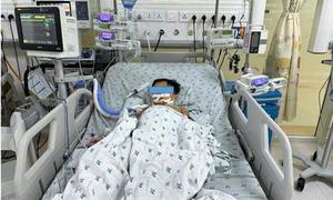 Ăn thịt chuột đồng một tuần, 3 trẻ rối loạn đông máu, một bé phải thở máy