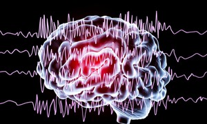 Động kinh ở trẻ em có chữa khỏi được không?
