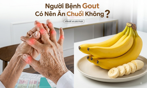 Người bệnh gout có nên ăn chuối không?