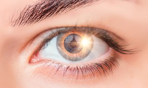 Cô gái suốt đời thấy hình lưỡi liềm trong mắt chỉ sau vài giây xem nhật thực