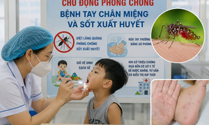 Dịch tay chân miệng và sốt xuất huyết tại Lâm Đồng diễn biến phức tạp