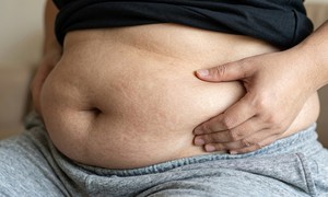 Vì sao người thức khuya hay bị tích mỡ bụng?