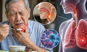 3 bệnh thường gặp ở người cao tuổi khi giao mùa