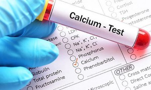 Làm sao phân biệt hạ kali và hạ canxi?