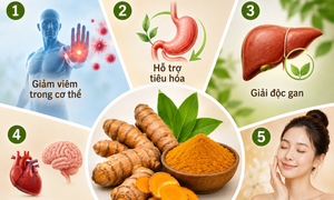 Nghệ có những lợi ích gì đối với sức khỏe?