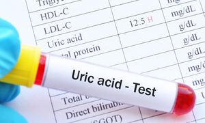 Tăng acid uric có làm suy giảm ‘bản lĩnh’ nam giới?