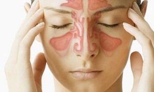 5 yếu tố làm tăng nguy cơ viêm xoang