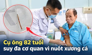 Cụ ông 82 tuổi suy đa cơ quan, sốc nhiễm trùng vì nuốt phải xương cá