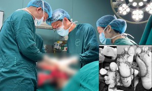 Suýt mất 2 bàn chân vì tự chườm nóng tại nhà khi bị tê bì
