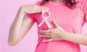 Khi nào cần làm xét nghiệm gene ung thư vú?