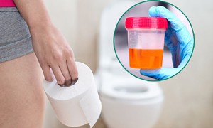Không chủ quan khi tiểu ra máu