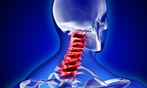 Ai cần thận trọng hoặc không nên tự ý kéo giãn cột sống cổ?