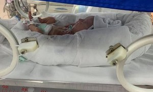 Các yếu tố nguy cơ dẫn đến sinh non mẹ bầu cần lưu ý