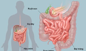 5 sai lầm khi chăm sóc người cao tuổi bị khó tiêu kéo dài