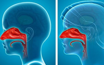 C&#225;c bệnh do vi&#234;m đường h&#244; hấp tr&#234;n: Dấu hiệu, điều trị v&#224; ph&#242;ng ngừa