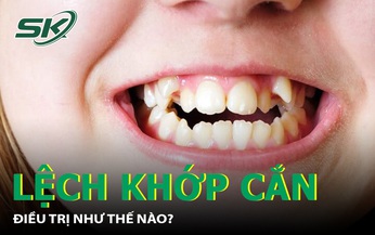 Lệch khớp cắn chữa trị như thế n&#224;o?