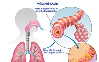 M&#243;n ăn, b&#224;i thuốc trị vi&#234;m phế quản t&#225;i ph&#225;t trong m&#249;a đ&#244;ng