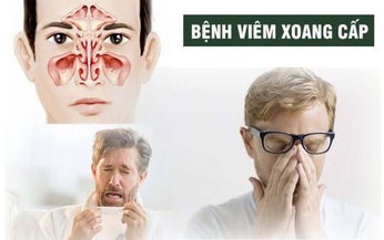 Vi&#234;m mũi xoang cấp: C&#225;ch ph&#242;ng v&#224; điều trị đ&#250;ng trong thời tiết lạnh