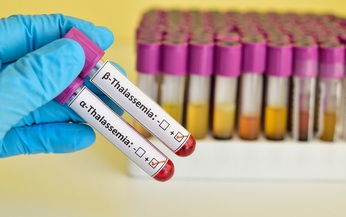 Mang gen bệnh thalassemia vẫn c&#243; thể sinh con khoẻ mạnh
