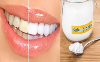 Chuy&#234;n gia tư vấn: D&#249;ng Baking soda l&#224;m trắng răng  v&#224; chăm s&#243;c răng miệng- Những lầm tưởng tai hại