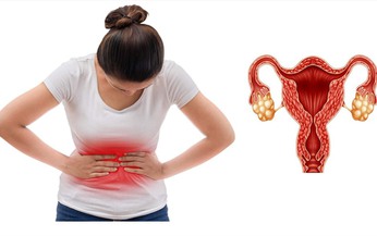Những bất thường ở buồng trứng gây hiếm muộn