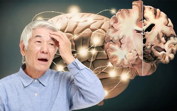 C&#225;ch ngăn ngừa bệnh Alzheimer tiến triển