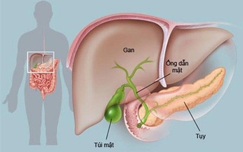  Ung thư tụy: Ti&#234;n lượng bệnh v&#224; c&#225;ch ph&#242;ng ngừa 