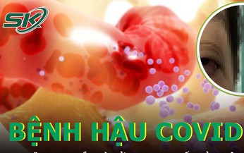 Gia tăng bệnh nhân mắc cốt tủy viêm xương hậu COVID-19, nhiều trường hợp tử vong