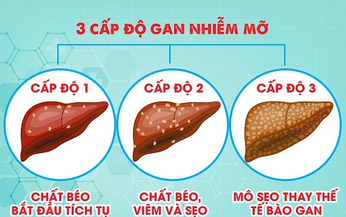 4 m&#243;n ăn b&#224;i thuốc ph&#242;ng trị gan nhiễm mỡ