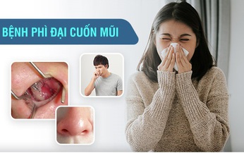 Ngạt mũi liên tục gây khó thở, khó ngủ: nguyên nhân và cách điều trị