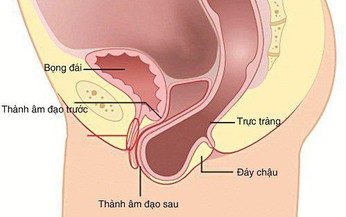 Sa trực tr&#224;ng dễ nhầm với bệnh g&#236;? Ai hay bị sa trực tr&#224;ng?