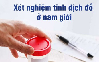 &#221; nghĩa c&#225;c chỉ số của x&#233;t nghiệm tinh dịch đồ khi chẩn đo&#225;n v&#244; sinh