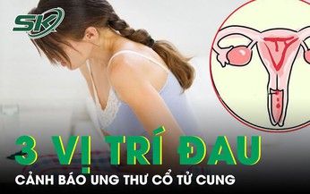3 vị trí đau cảnh báo ung thư cổ tử cung