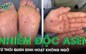 Ung thư tế b&#224;o gai, vảy nến, nhiễm độc thạch t&#237;n từ th&#243;i quen sinh hoạt kh&#244;ng ngờ