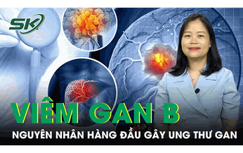 Vi&#234;m gan B: Nguy&#234;n nh&#226;n h&#224;ng đầu g&#226;y ung thư gan 