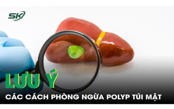 Lưu ý các cách phòng ngừa polyp túi mật