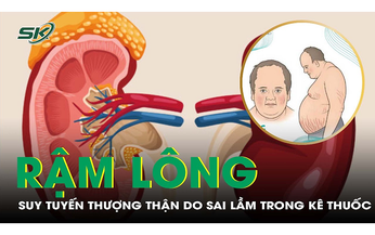 B&#233; trai 13 tuổi suy tuyến thượng thận, rậm l&#244;ng v&#236; lạm dụng thuốc