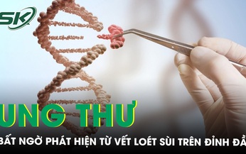 Đầu lở lo&#233;t, chảy dịch, đi kh&#225;m ph&#225;t hiện ung thư