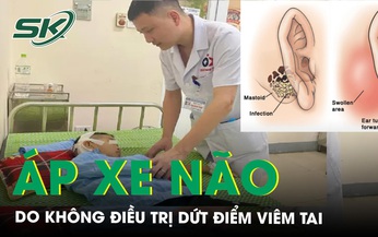 Nguy kịch v&#236; kh&#244;ng điều trị dứt điểm vi&#234;m tai dẫn tới biến chứng &#225;p xe n&#227;o