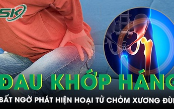 Đau khớp h&#225;ng dữ dội đi kh&#225;m bất ngờ ph&#225;t hiện hoại tử chỏm xương đ&#249;i 