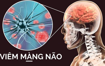 Những c&#226;u hỏi li&#234;n quan bệnh vi&#234;m m&#224;ng n&#227;o mủ