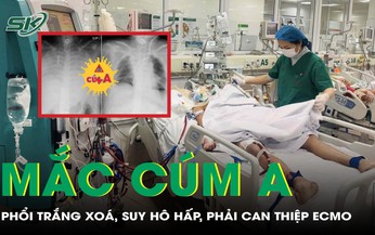 Mắc c&#250;m A suốt 3 tuần, người đ&#224;n &#244;ng nguy kịch, phổi trắng x&#243;a, phải can thiệp ECMO khẩn cấp
