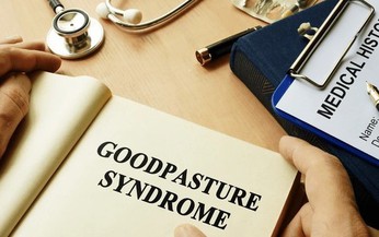 6 câu hỏi thường gặp về hội chứng Goodpasture