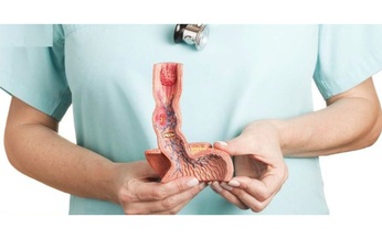 Câu hỏi thường gặp liên quan đến bệnh giãn tĩnh mạch thực quản