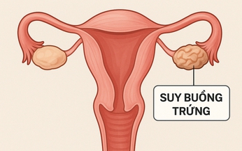 Câu hỏi thường gặp liên quan đến bệnh suy buồng trứng