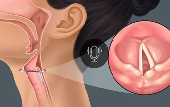 Câu hỏi thường gặp liên quan đến bệnh lao thanh quản
